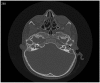 Fig. 5.