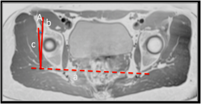 Fig. 3