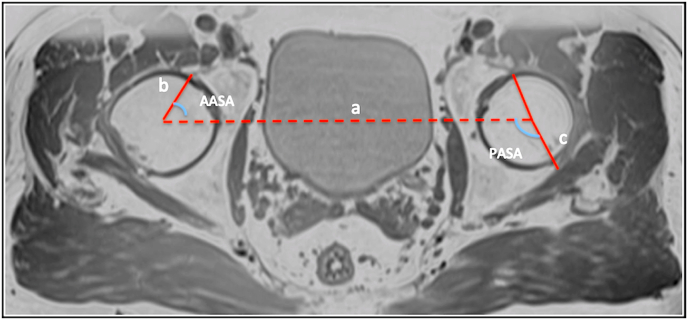 Fig. 2