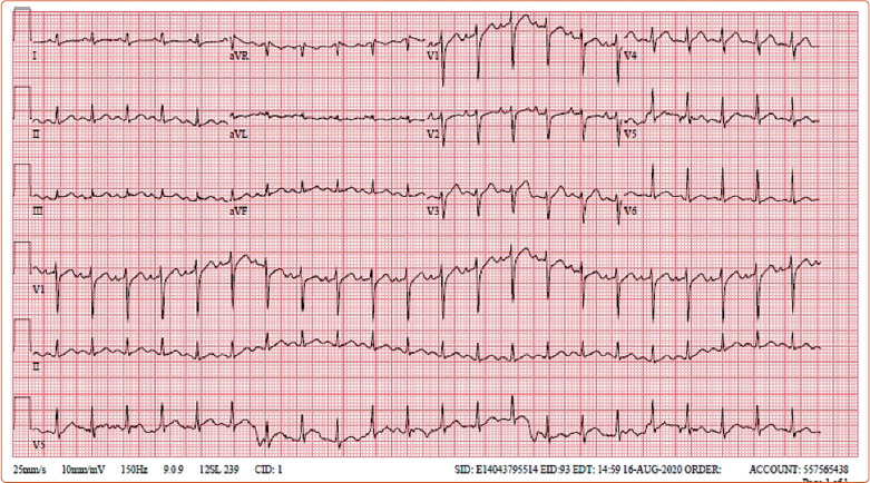 Figure 1: