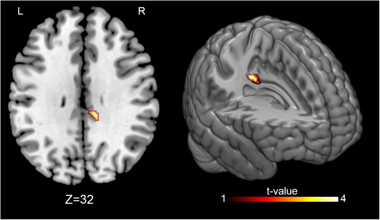 FIGURE 4