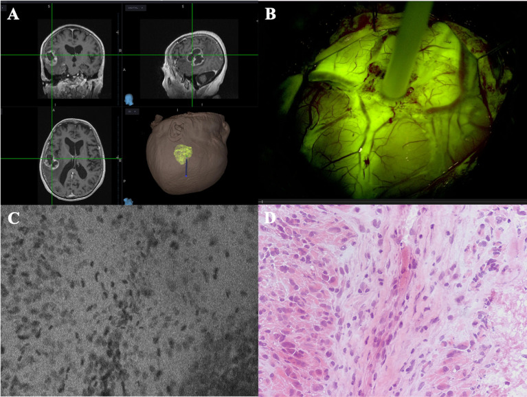 Figure 3