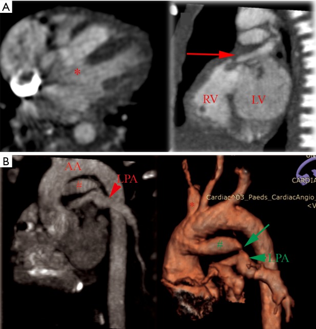 Figure 20