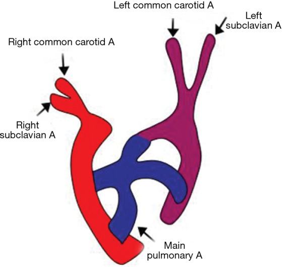 Figure 17