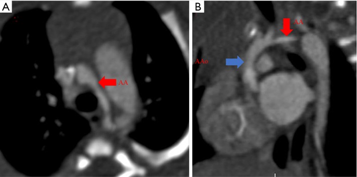 Figure 18