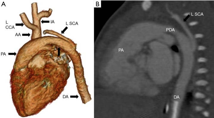 Figure 16