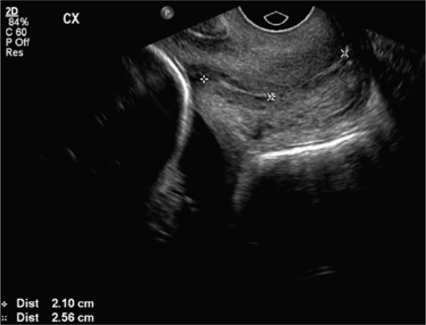 Fig. –