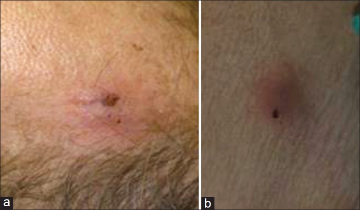 Figure 1(a and b)