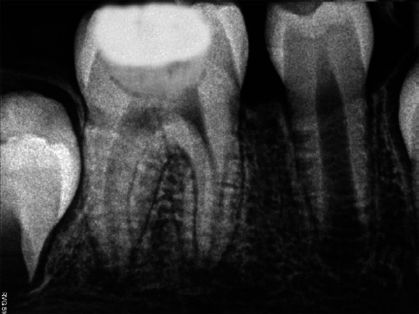 Fig. 4e: