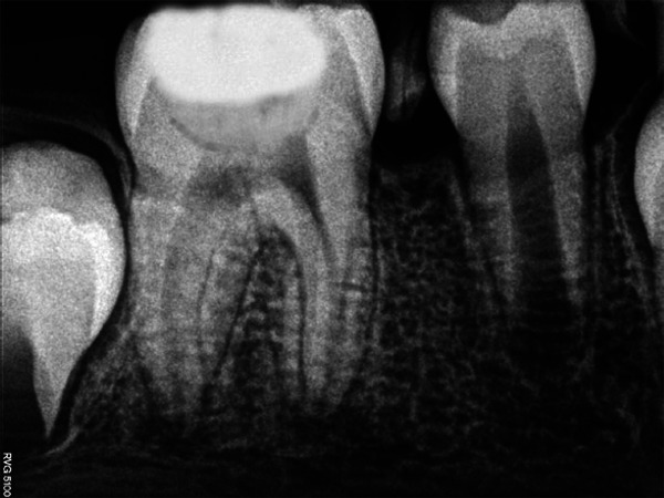 Fig. 4b: