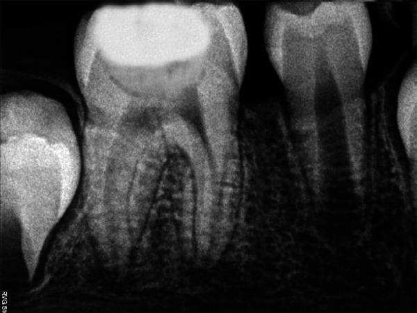 Fig. 4c: