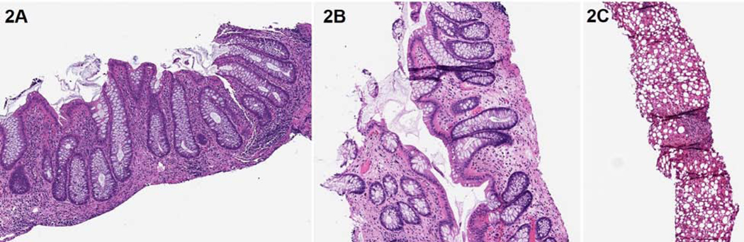 Figure 2: