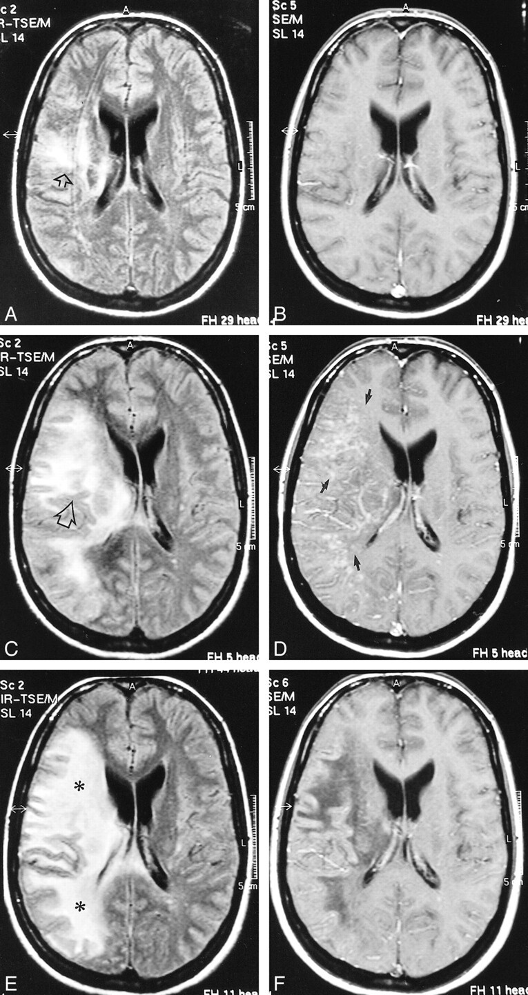 fig 1.