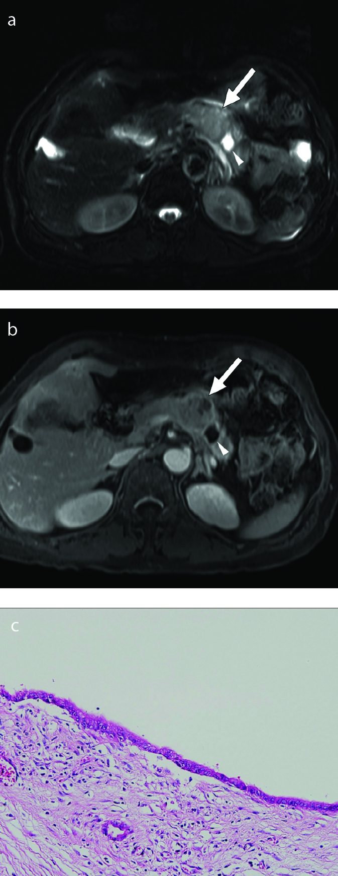 Figure 11. a–c