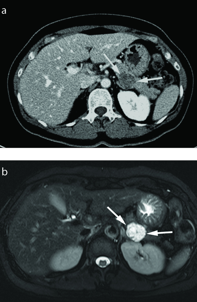 Figure 3. a, b