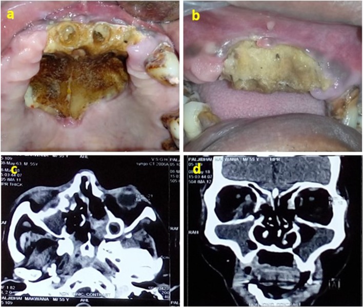 Fig. 3