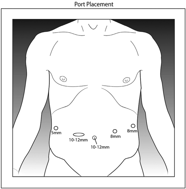 Fig. 21.