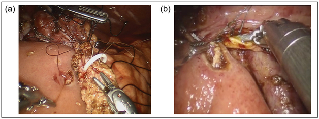 Fig. 15.