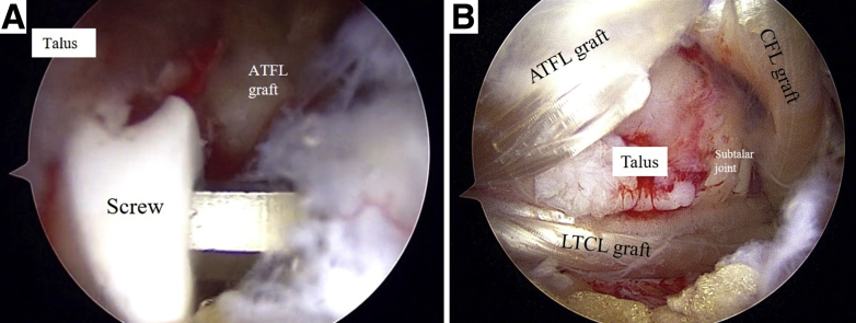 Fig 6