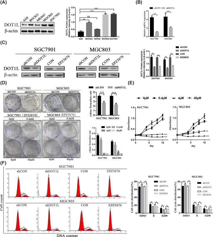 The Role Of Dot L In The Proliferation And Prognosis Of Gastric Cancer