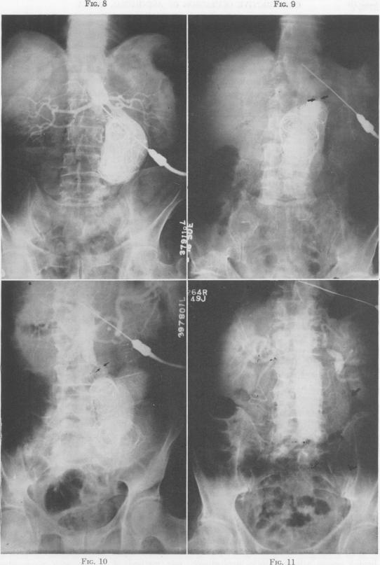 Fig. 8., Fig. 9., Fig. 10., Fig. 11.