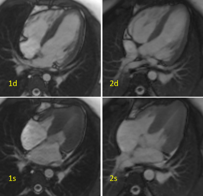 Fig 2