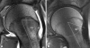 Fig. 4A–B