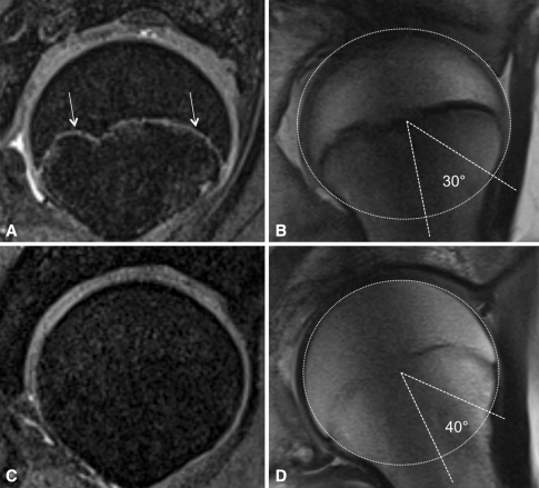 Fig. 2A–D