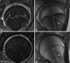 Fig. 2A–D