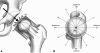 Fig. 1A–B