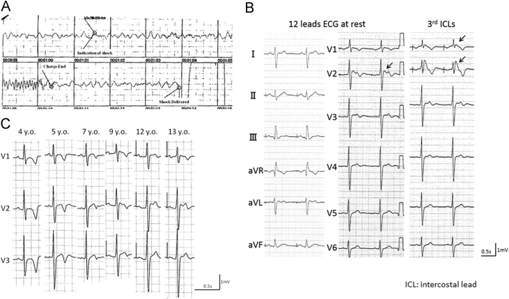 Fig. 2