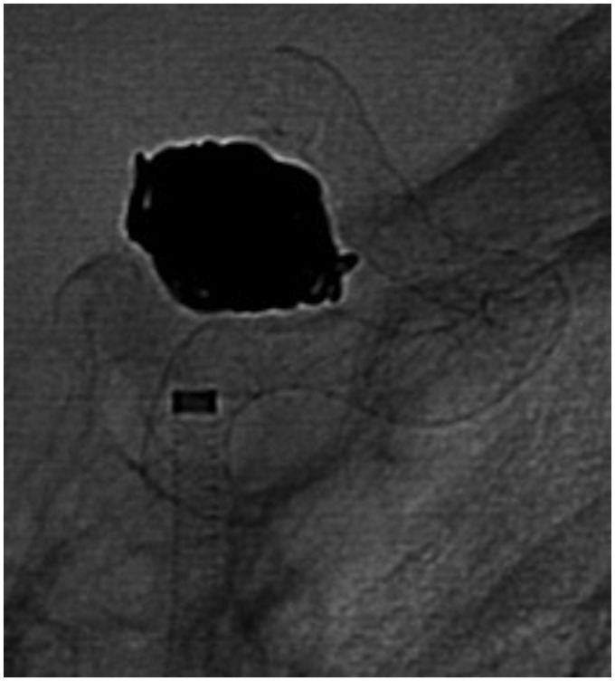 Figure 1.