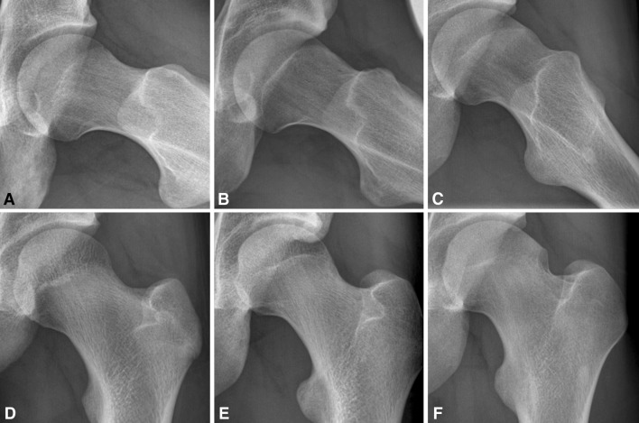 Fig. 1A–F