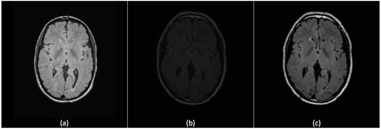 Fig. (3)