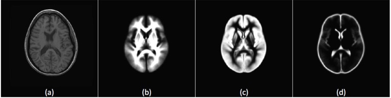 Fig. (2)