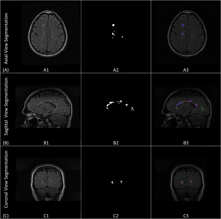 Fig. (5)