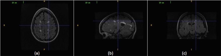 Fig. (4)