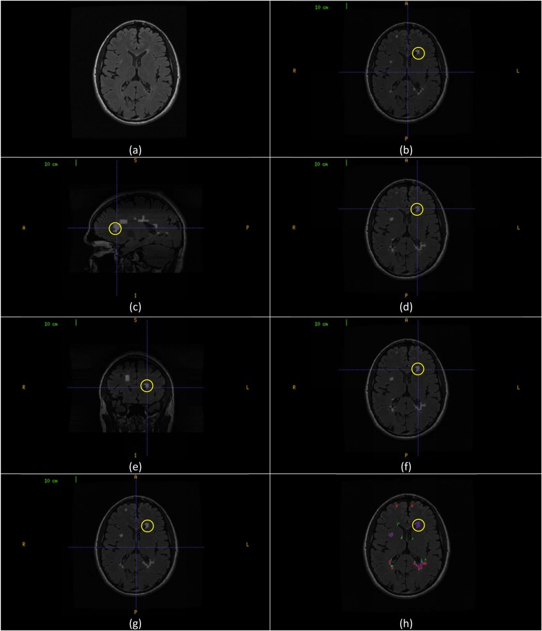 Fig. (7)