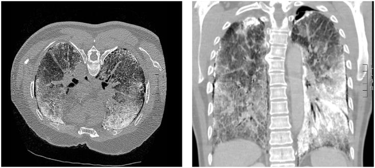 Fig. 2