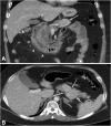 Figure 1. A: