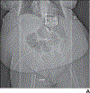 Fig. 2—
