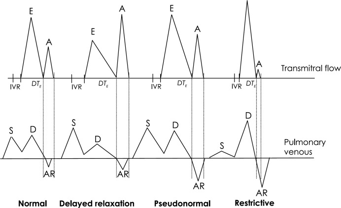 graphic file with name 10.1053_jfms.2002.0200-fig1.jpg