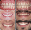 Figure 16:
