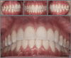 Figure 13: