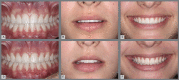 Figure 6: