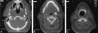 <sc>fig</sc> 2.