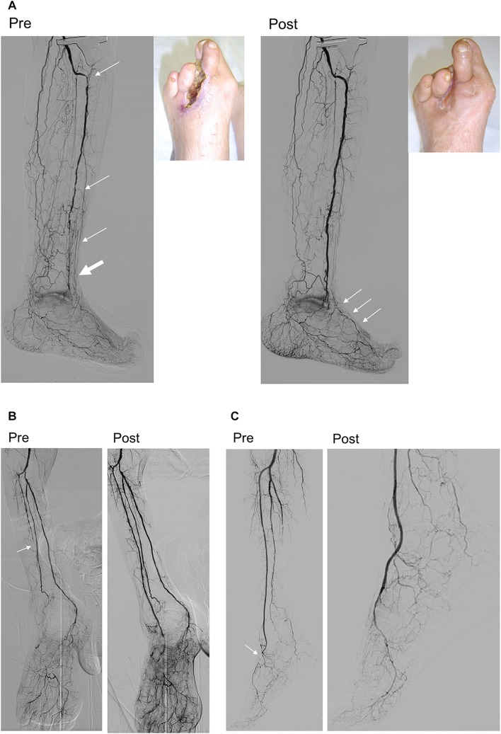 Fig. 14