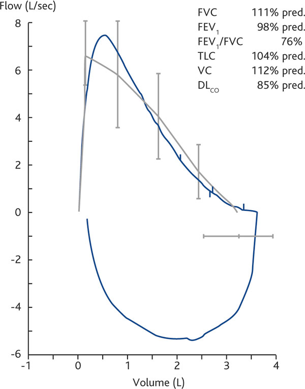 Figure 2b