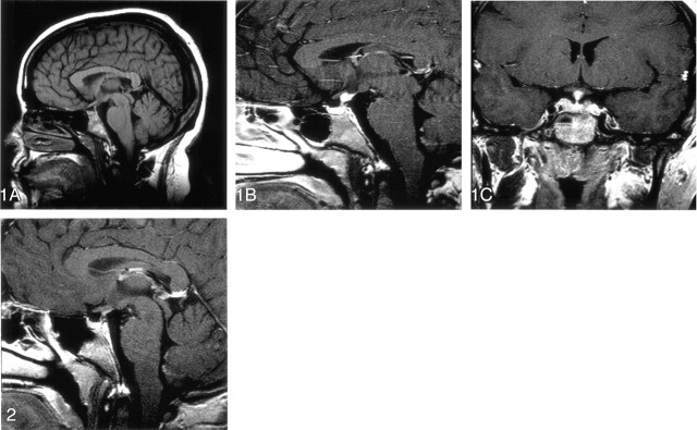 Fig 1.