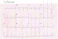 [Table/Fig-2]: